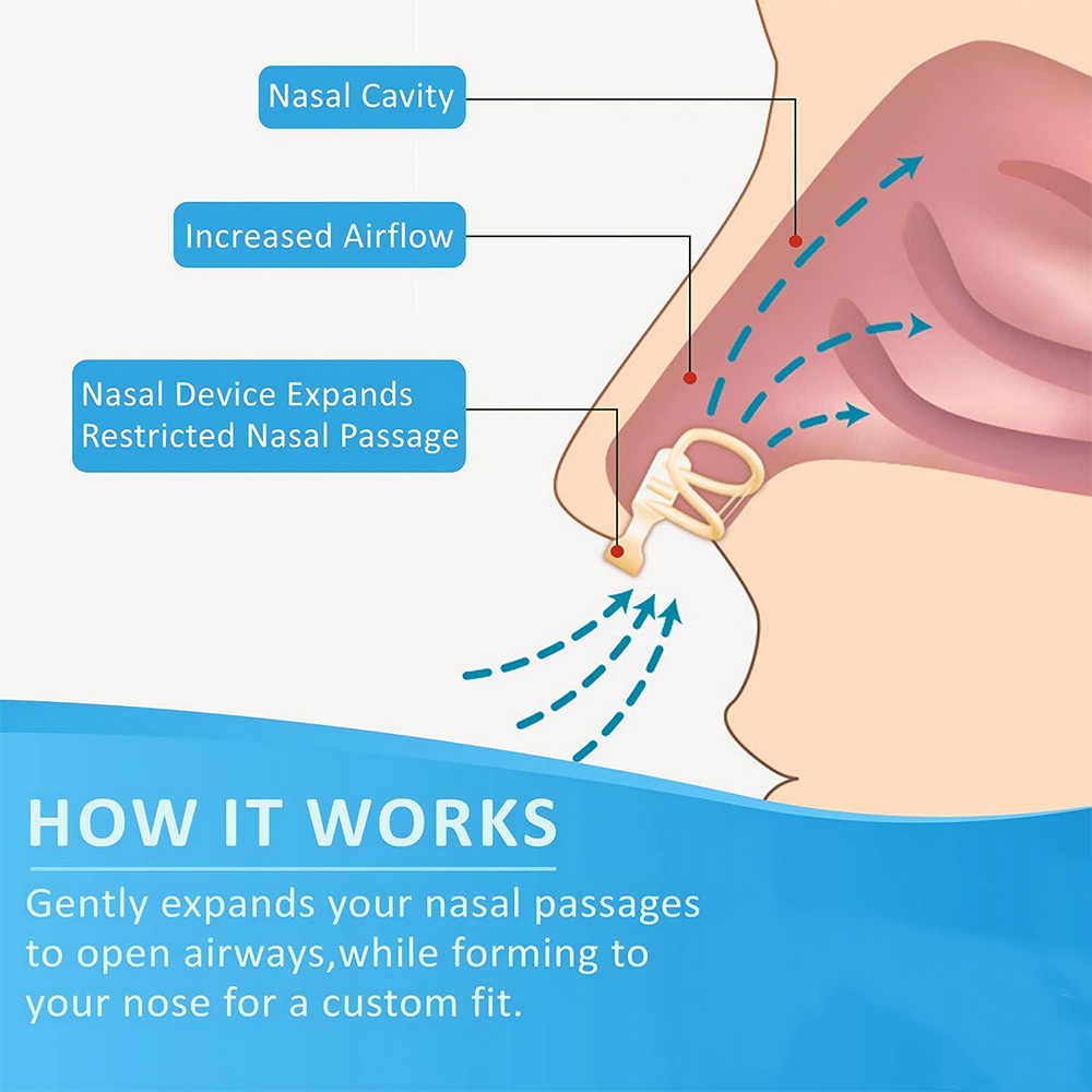 Snore Stopper Nasal Dilator fo - Anti Snore Contour Pillow recension och pris